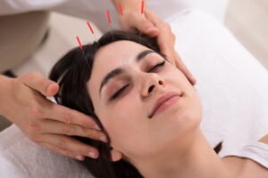 Read more about the article Managing Winter Stress and Anxiety in Ottawa: How I Use Acupuncture to Restore Calm and Balance